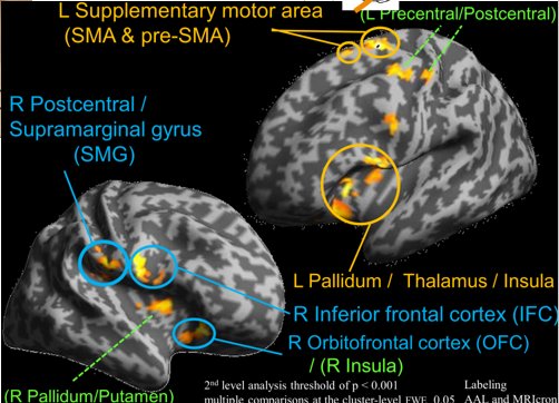 Brain activity during wearable robot use